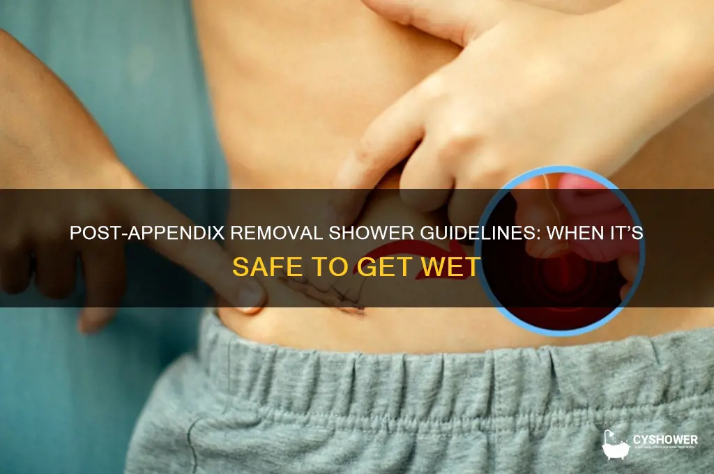 when can i shower after appendix removal