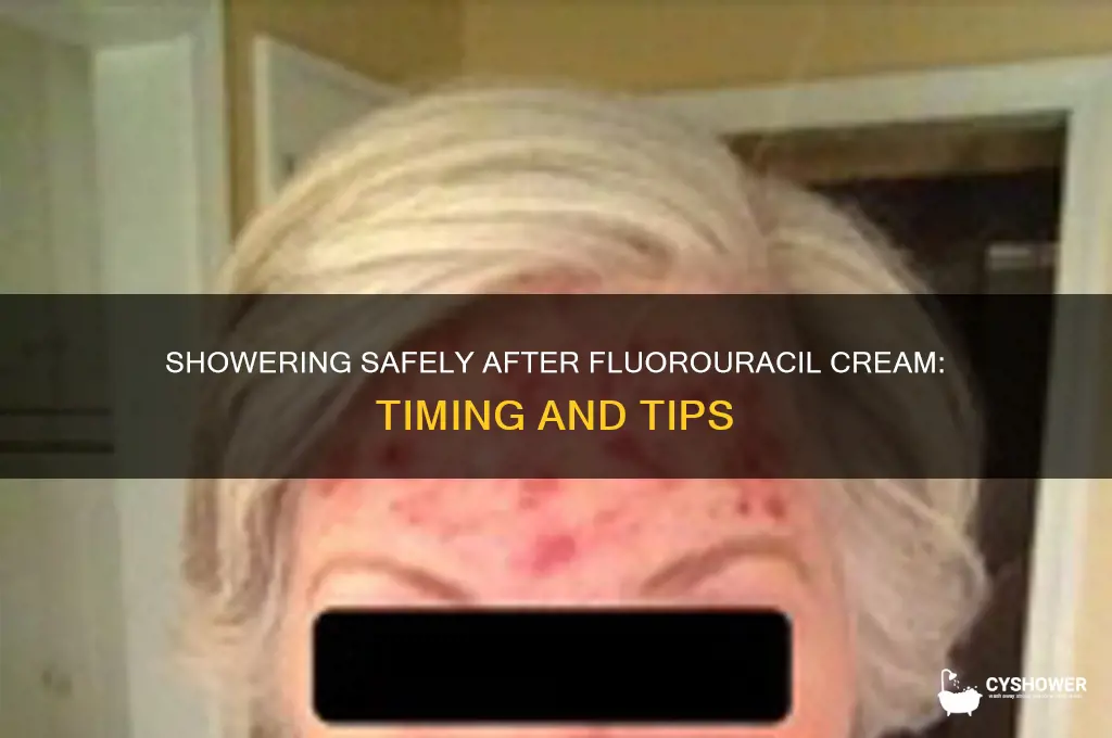 when can i shower after applying fluorouracil cream