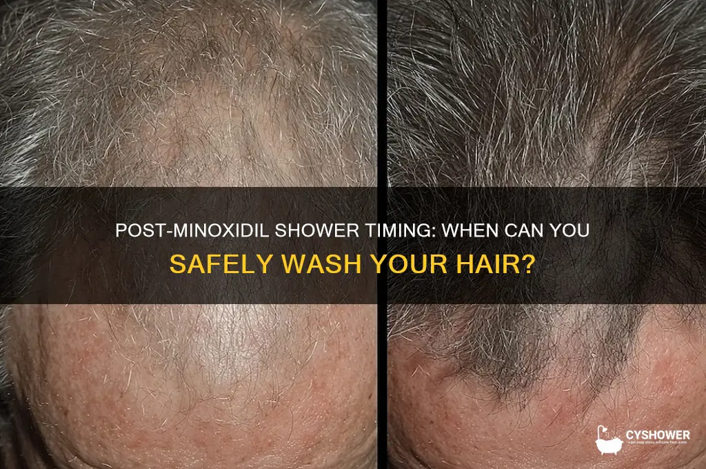 when can i shower after applying minoxidil