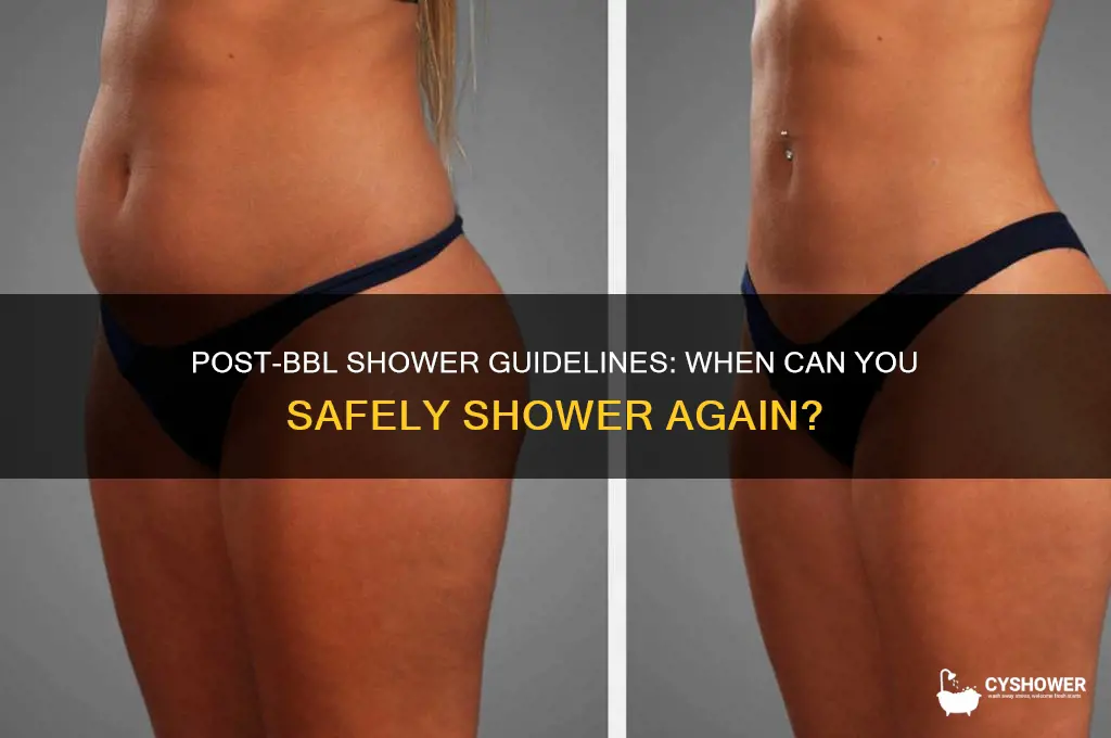 when can i shower after bbl