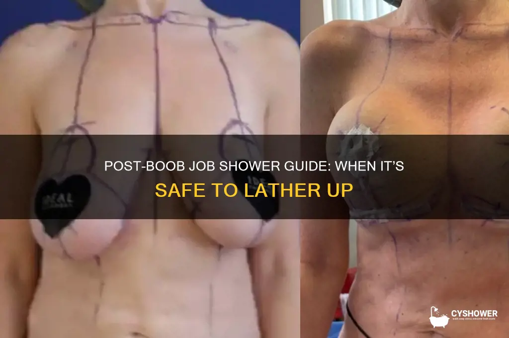 when can i shower after boob job