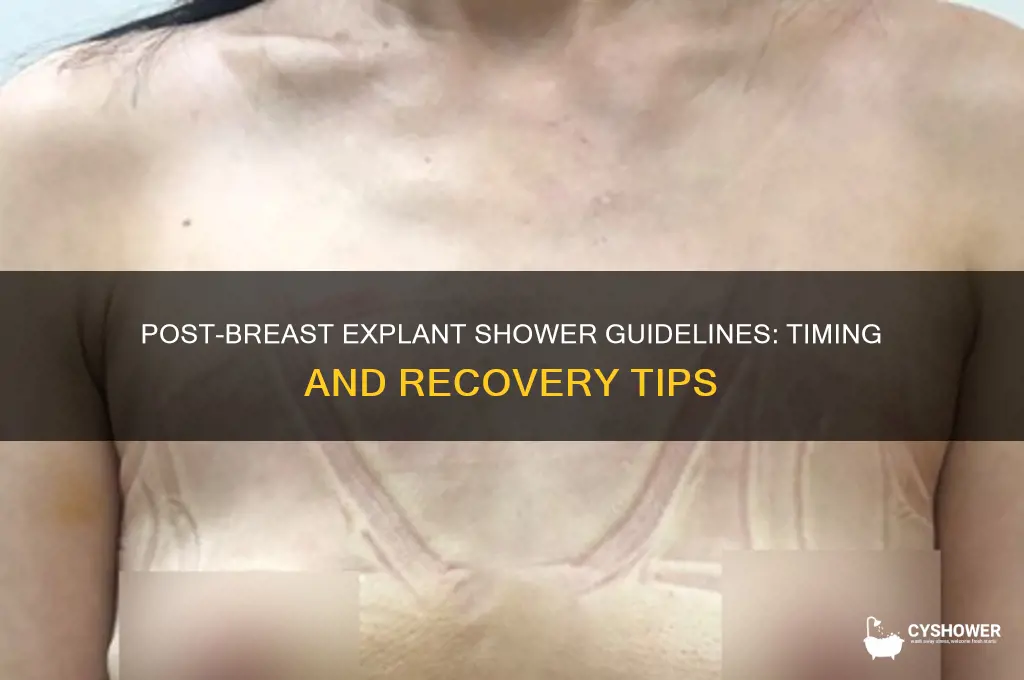when can i shower after breast explantation