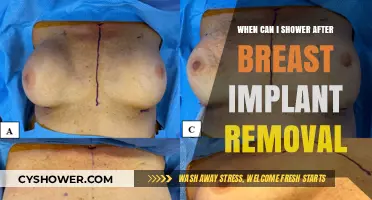 Post-Breast Implant Removal: Safe Showering Timeline and Recovery Tips