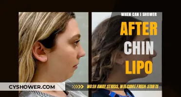 Post-Chin Lipo Shower Guide: Timing and Tips for Safe Recovery