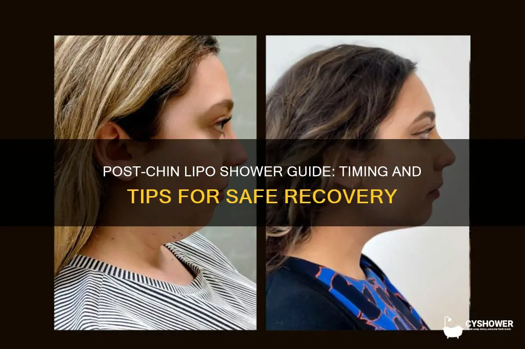 when can i shower after chin lipo