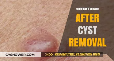 Post-Cyst Removal Shower Guidelines: When Can You Safely Shower?