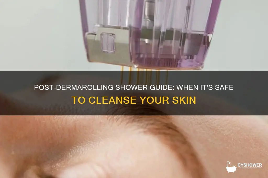 when can i shower after dermarolling