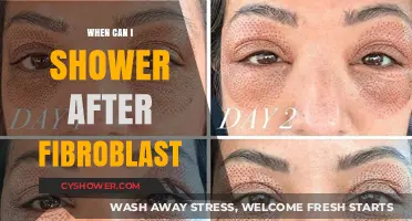 Post-Fibroblast Shower Guidelines: When It’s Safe to Cleanse Your Skin