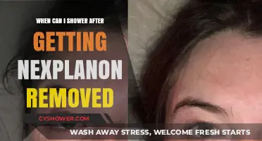 Post-Nexplanon Removal: When Is It Safe to Shower Again?
