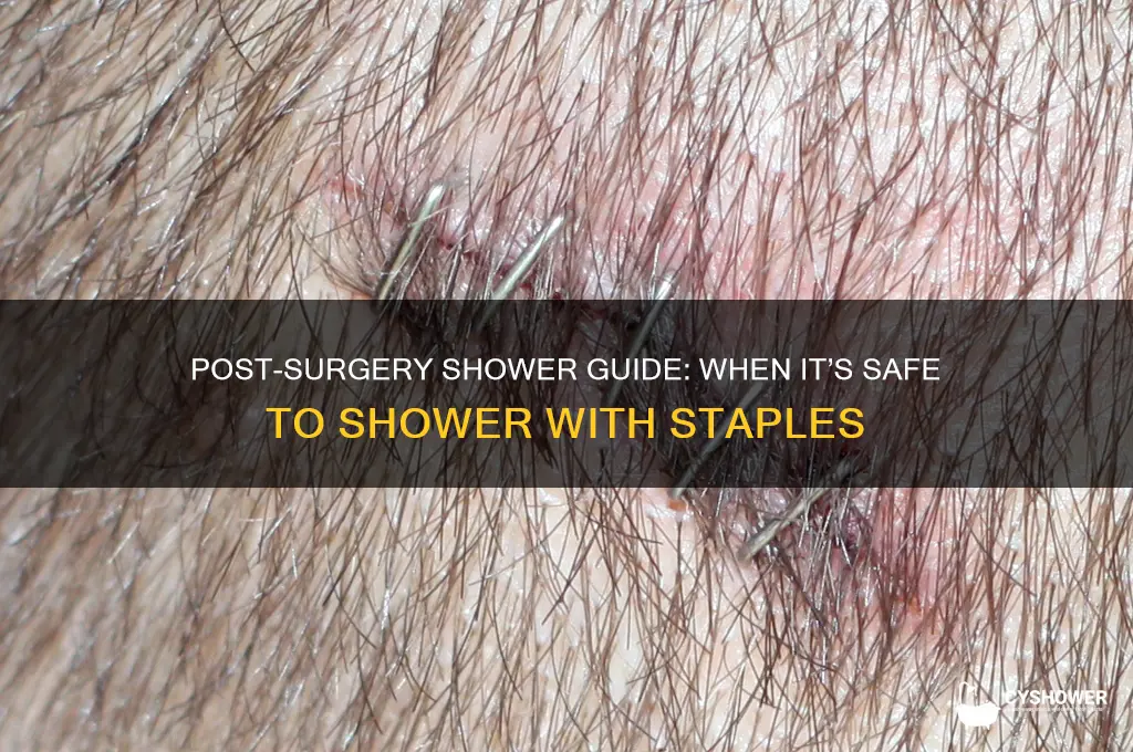 when can i shower after getting staples