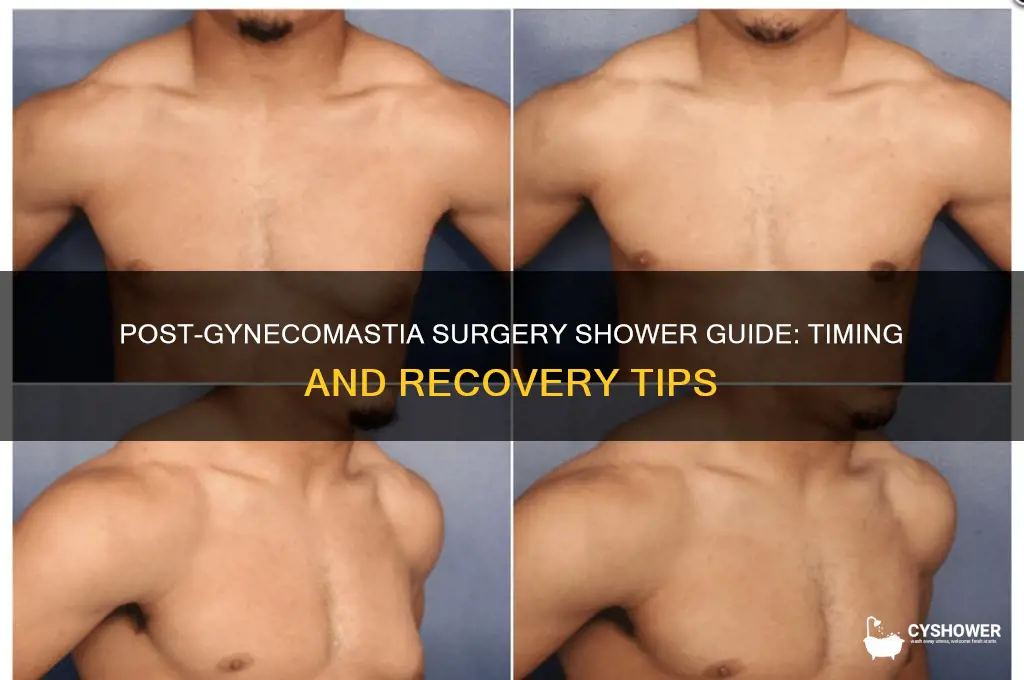 when can i shower after gynecomastia surgery