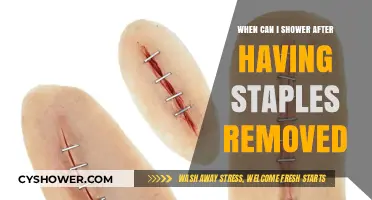 Post-Surgery Shower Guide: When It’s Safe After Staple Removal