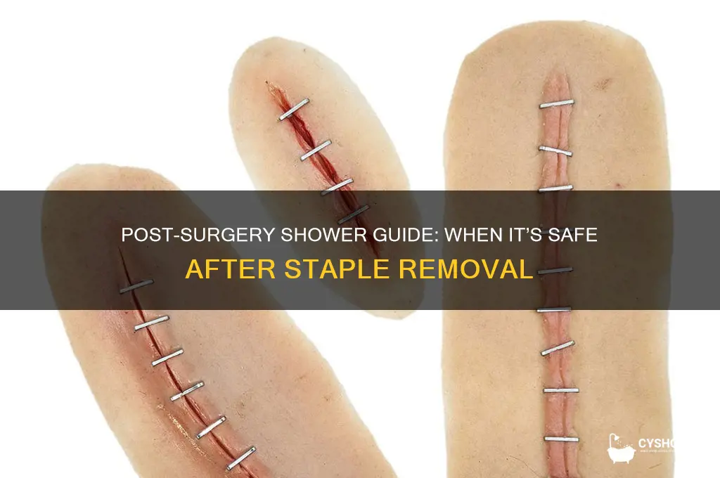 when can i shower after having staples removed
