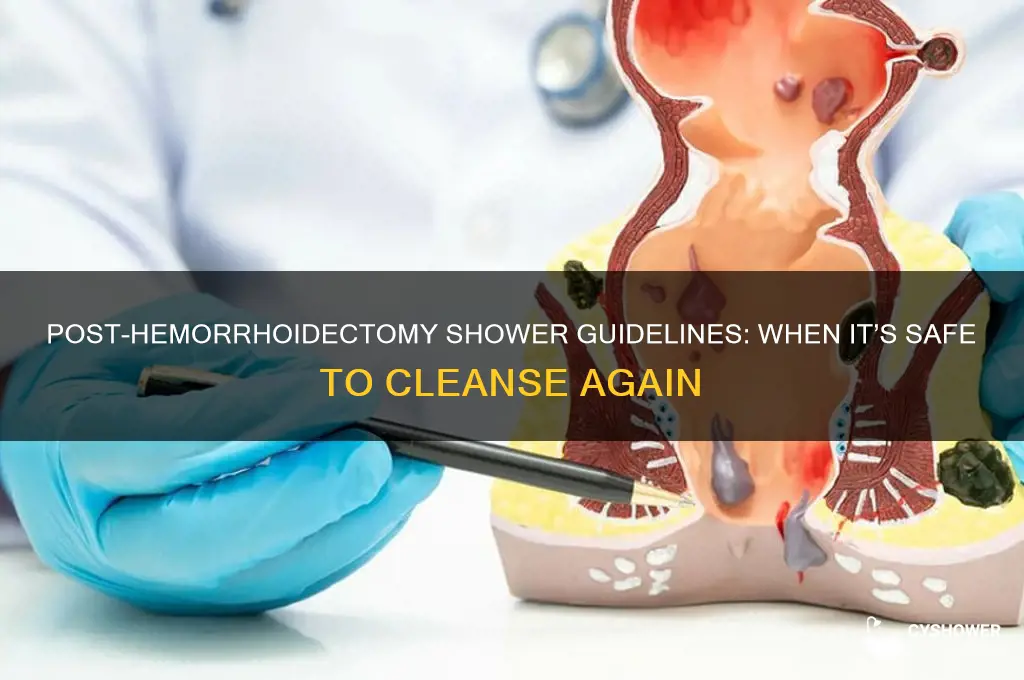 when can i shower after hemorrhoid surgery