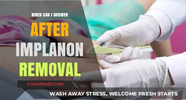 Showering Safely After Implanon Removal: What You Need to Know