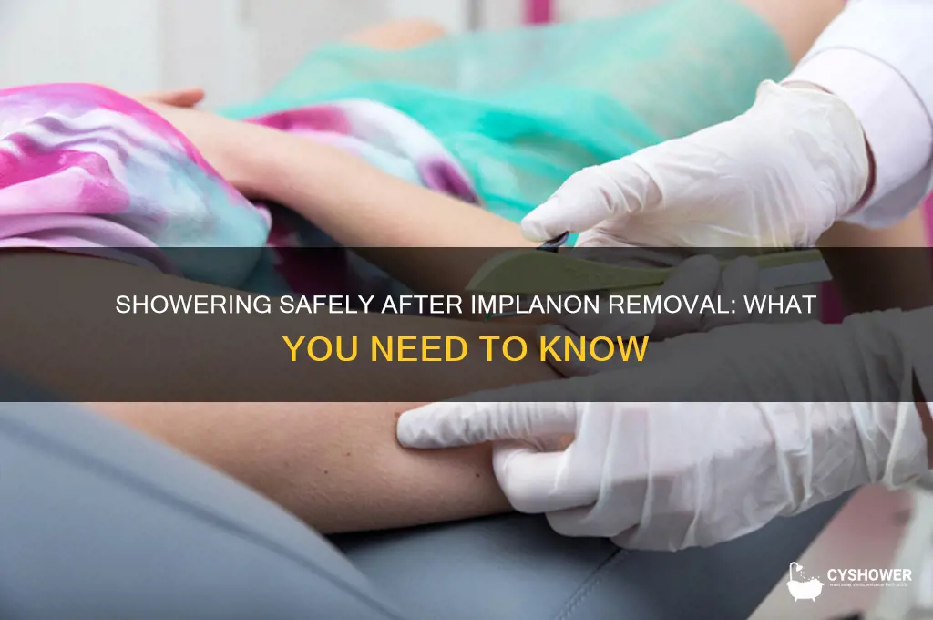 when can i shower after implanon removal