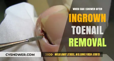 Post-Ingrown Toenail Removal: Safe Showering Timeline and Tips