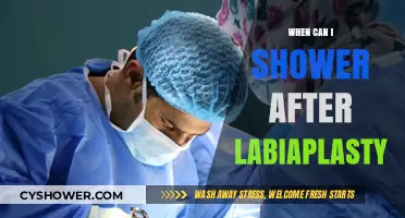 Post-Labiaplasty Shower Guidelines: When It’s Safe to Cleanse Again