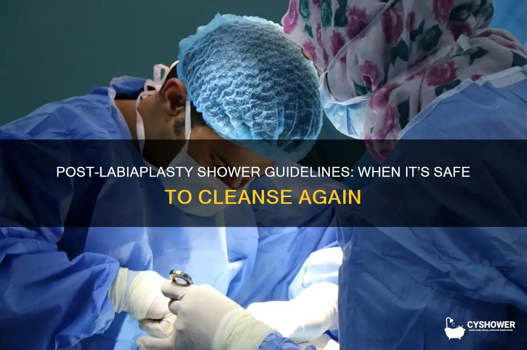 when can i shower after labiaplasty
