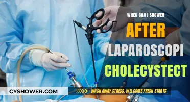 Post-Laparoscopic Cholecystectomy Shower Guidelines: When Is It Safe?