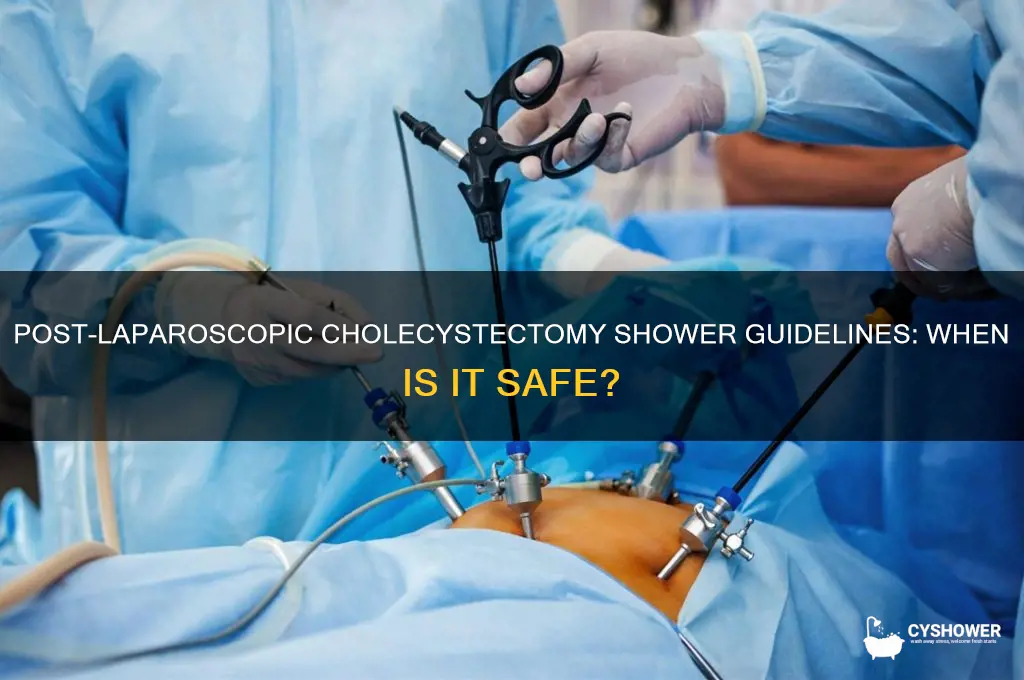 when can i shower after laparoscopic cholecystectomy