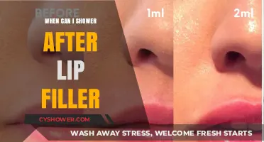 Post-Lip Filler Care: When Is It Safe to Shower Again?