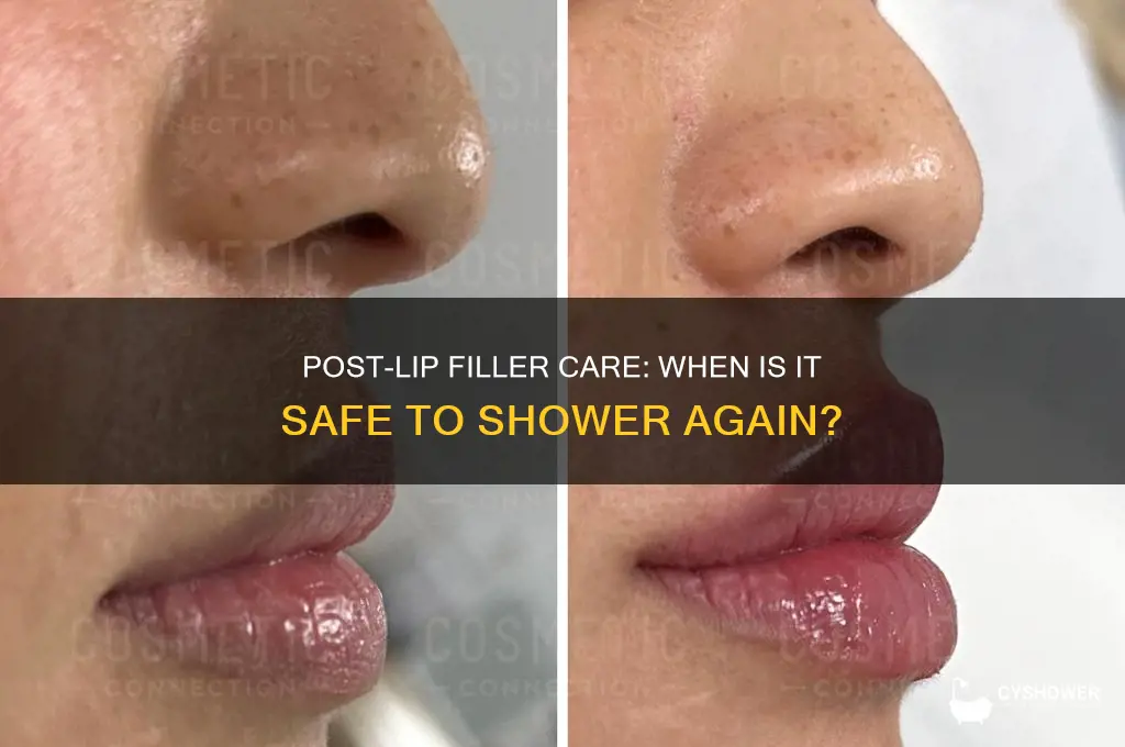 when can i shower after lip filler