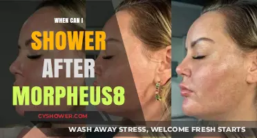 Post-Morpheus8 Shower Guide: Safe Timing for Skin Recovery