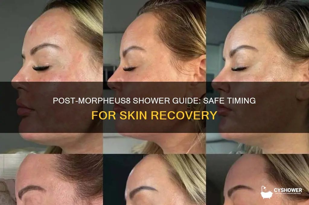 when can i shower after morpheus8