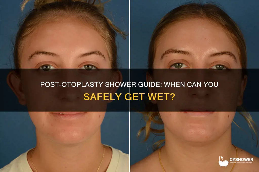 when can i shower after otoplasty