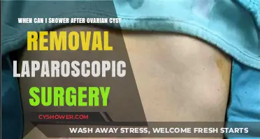Post-Laparoscopic Ovarian Cyst Removal: Safe Showering Timeline Explained