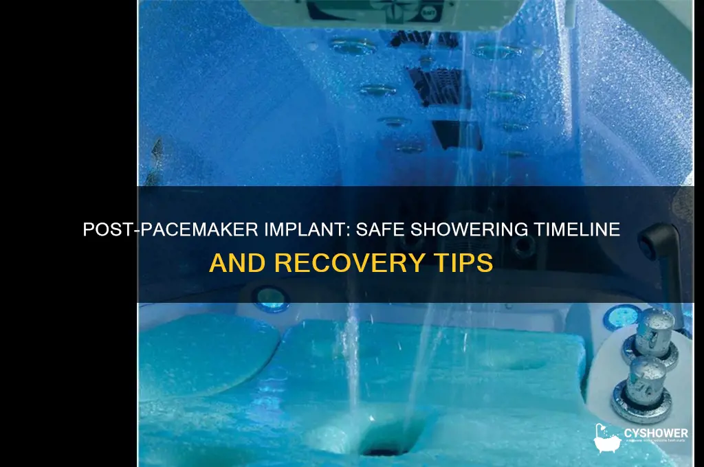 when can i shower after pacemaker implant