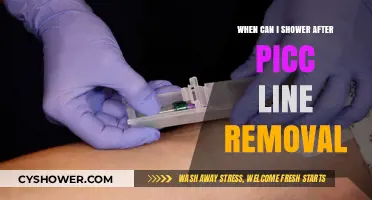 Post-PICC Line Removal: When Is It Safe to Shower Again?
