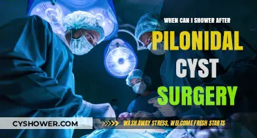 Post-Pilonidal Cyst Surgery: Safe Showering Timeline and Tips