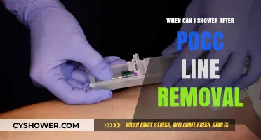 Showering Safely After PICC Line Removal: Timing and Tips