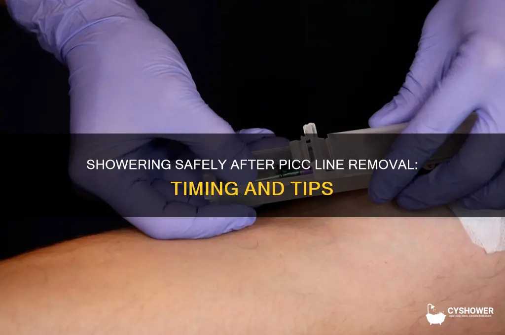 when can i shower after pocc line removal