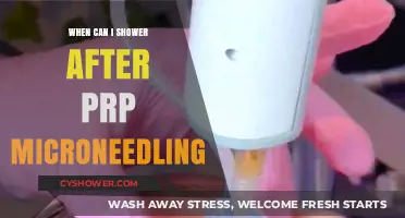 Post-PRP Microneedling Shower Guide: Timing and Tips for Optimal Healing