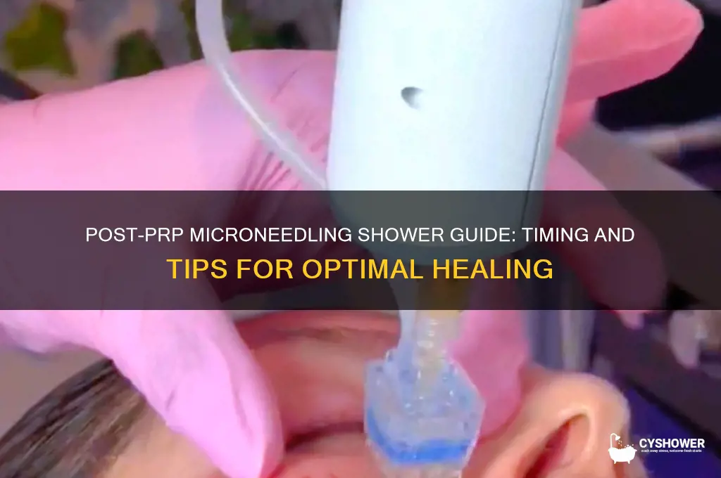 when can i shower after prp microneedling