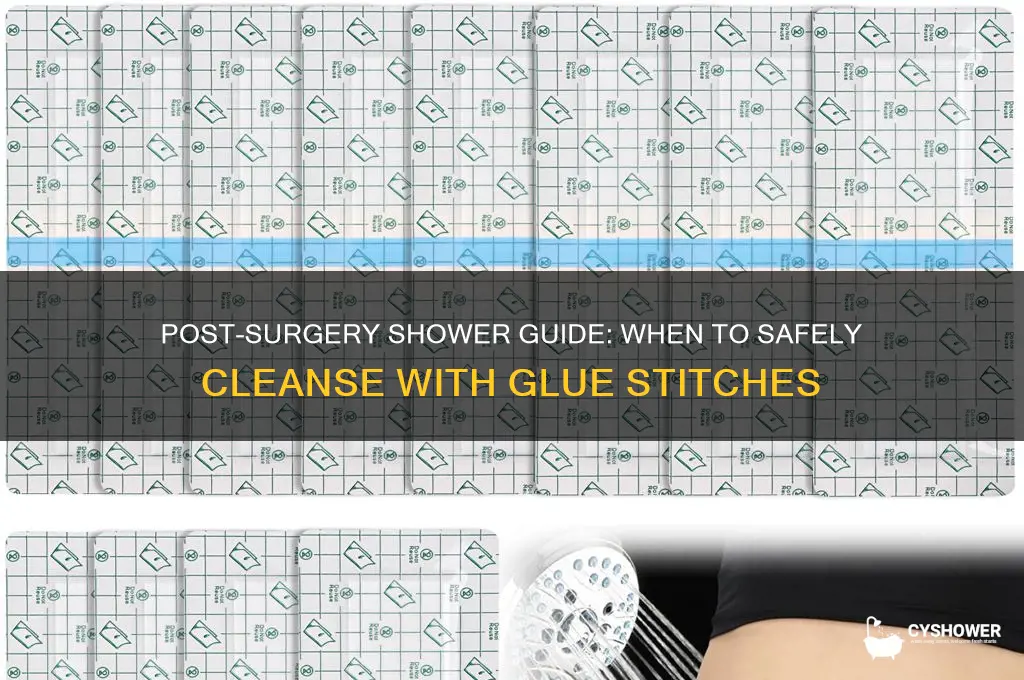 when can i shower after surgery and glue stiches