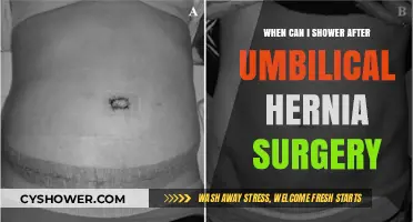 Post-Umbilical Hernia Surgery: Safe Showering Timeline and Tips