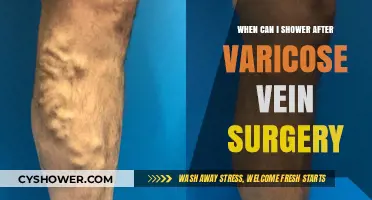 Post-Varicose Vein Surgery Shower Guidelines: Timing and Tips for Recovery