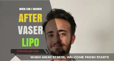 Post-Vaser Lipo Shower Guide: Timing and Tips for Safe Recovery