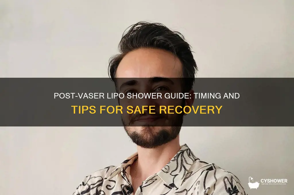 when can i shower after vaser lipo