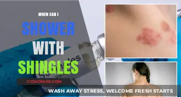 Shingles Recovery: Safe Showering Tips and Timeline for Healing