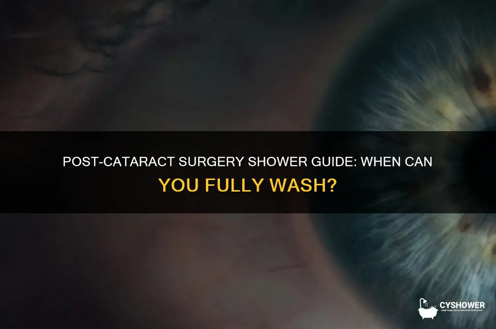 when can i take a full shower after cataract surgery