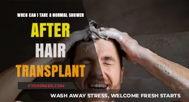 Post-Hair Transplant Shower Guide: When to Resume Normal Routine