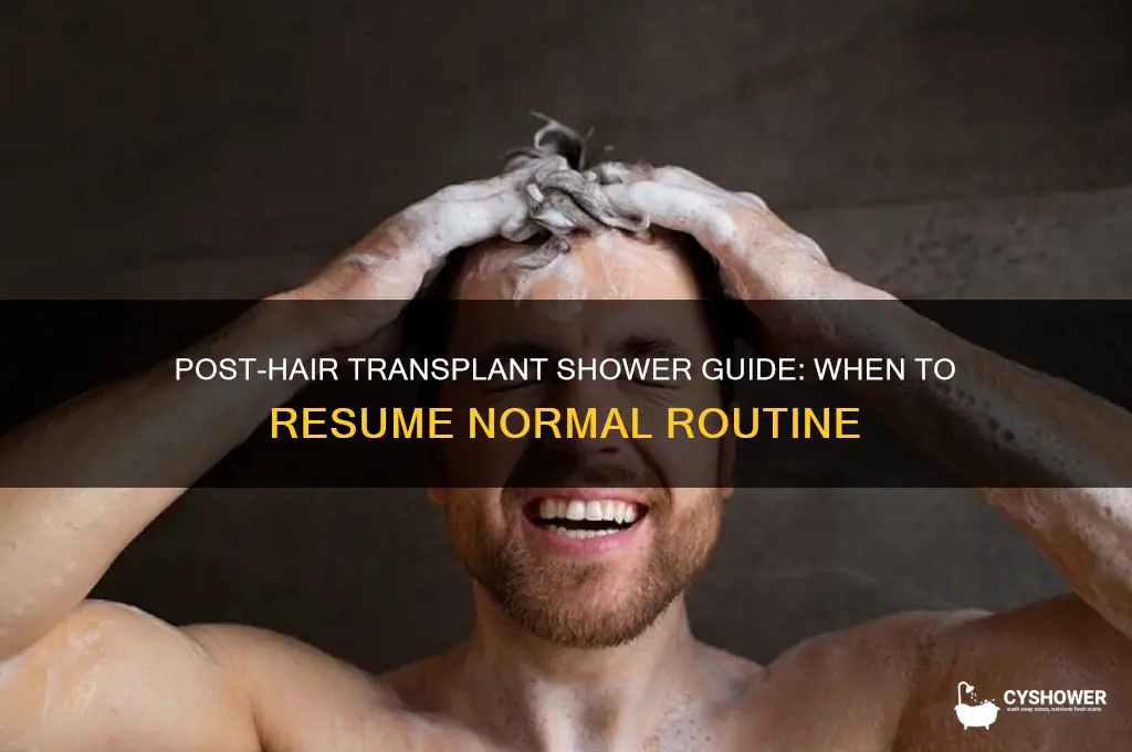 when can i take a normal shower after hair transplant