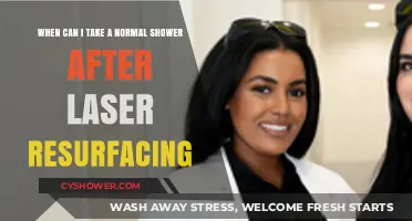 Post-Laser Resurfacing Shower Guide: When to Resume Normal Routine
