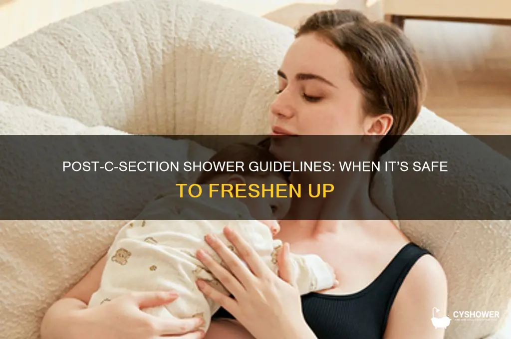 when can i take a shower after a c section