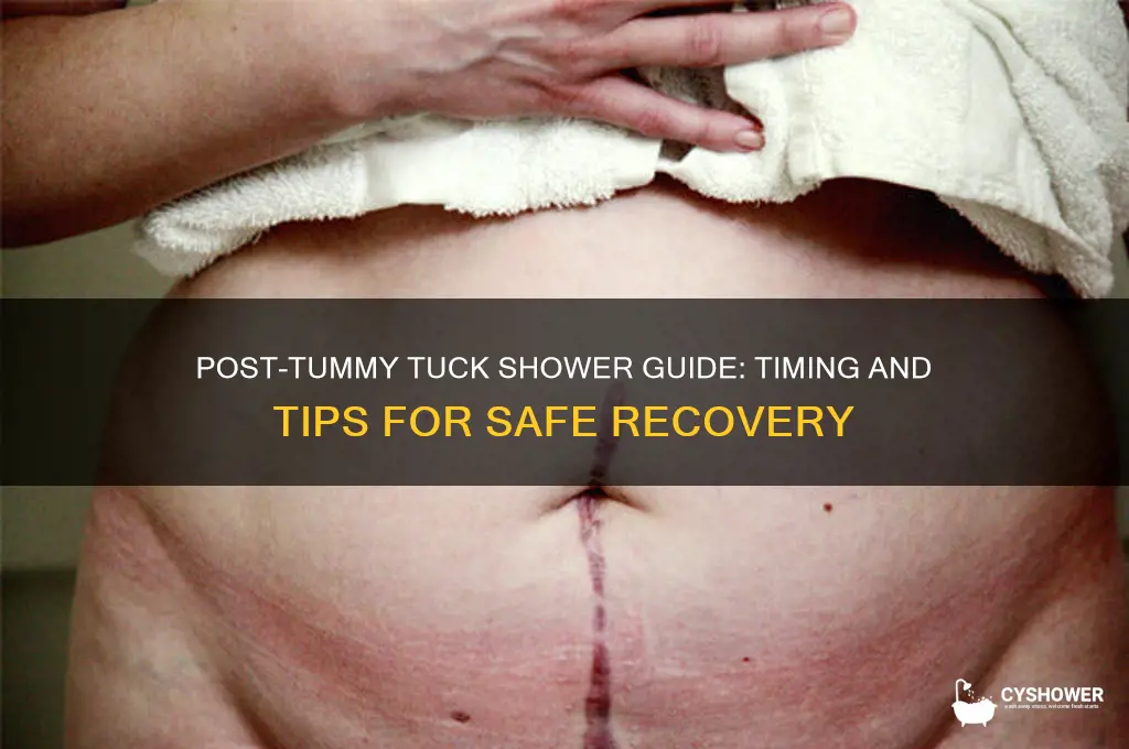 when can i take a shower after a tummy tuck